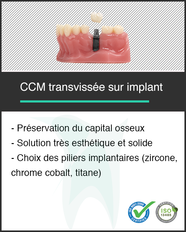 implant